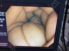 OLYMPUS High Definition Monitor