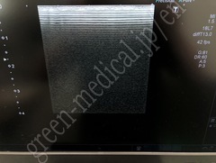 TOSHIBA Ultrasound Color Doppler
