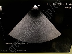 Hitachi Ultrasound Color Doppler