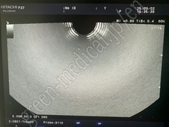 Hitachi Color Doppler Ultrasound System