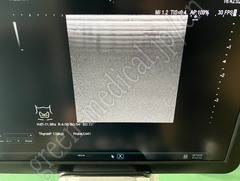 Hitachi Diagnostic  Ultrasound System