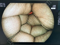 FUJIFILM Processor & Laser Lightsource