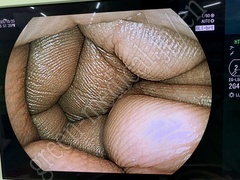 FUJIFILM Processor & Laser Lightsource