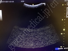 GE Healthcare Portable Ultrasound System