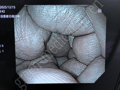 OLYMPUS Video System Center