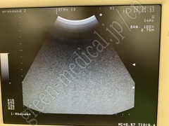 Hitachi Portable Ultrasound