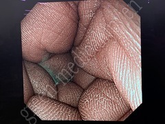 OLYMPUS Processor & Xenon Lightsource