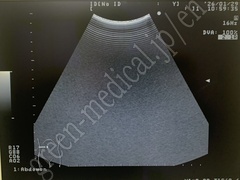 Hitachi Ultrasound