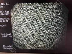 OLYMPUS Video Gastroscope