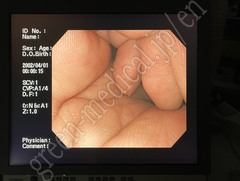 OLYMPUS Video Gastroscope