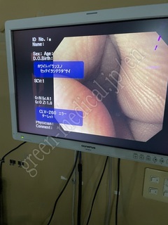 OLYMPUS Processor & Light Source