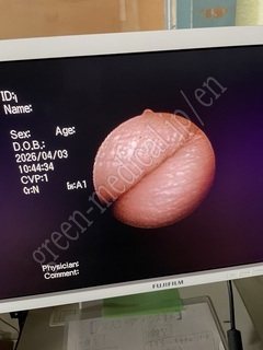 PENTAX Rhinolaryngoscope