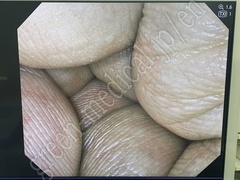 OLYMPUS Video System Center