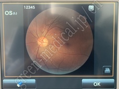 TOPCON Fundus Camera