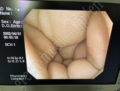 OLYMPUS Video Gastroscope