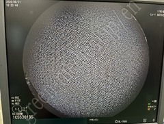 FUJIFILM Video Colonoscope