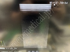 Hitachi Ultrasound Color Doppler