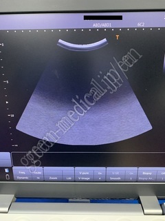 TOSHIBA Color Doppler Ultrasound