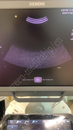 SIEMENS Color Doppler Ultrasound