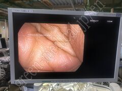 PENTAX Rhino Laryngoscope