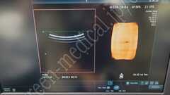 Hitachi Diagnostic Ultrasound Scanner