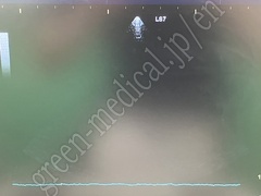 GE Healthcare Ultrasound Color Doppler