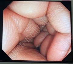 OLYMPUS Video Gastroscope