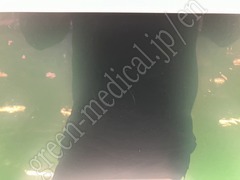SONY Medical Grade LCD Monitor