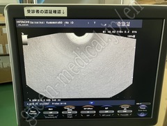 Hitachi Color Doppler Ultrasound System
