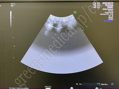 GE Healthcare Diagnostic Ultrasound System