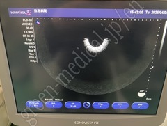 SIEMENS Ultrasound system