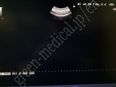 Hitachi Color Doppler Ultrasound System