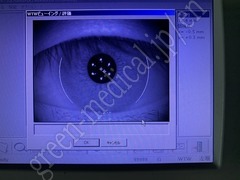 Carl Zeiss Optical Biometry