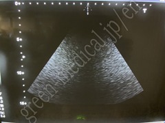 TOSHIBA Ultrasound Color Doppler