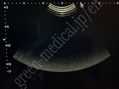 TOSHIBA Ultrasound Color Doppler