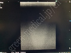 FUJIFILM Portable Ultrasound