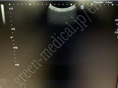 TOSHIBA Ultrasound Color Doppler