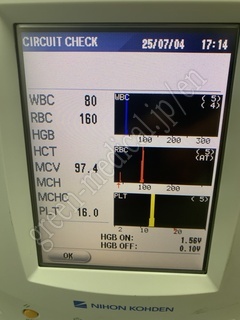 NIHON KOHDEN Hematology Analyzer