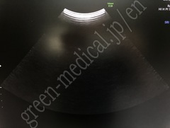 GE Healthcare Diagnostic Ultrasound System