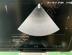 Hitachi Diagnostic  Ultrasound System