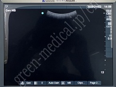 SonoSite Ultrasound Color Doppler