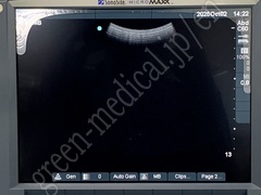 SonoSite Ultrasound Color Doppler