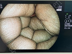 FUJIFILM Processor & Laser Lightsource