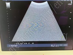 Hitachi Ultrasound Color Doppler