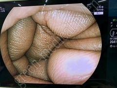 FUJIFILM Processor & Laser Lightsource