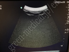 SonoSite Ultrasound Color Doppler