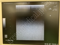 Hitachi Portable Ultrasound