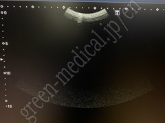TOSHIBA Ultrasound Color Doppler
