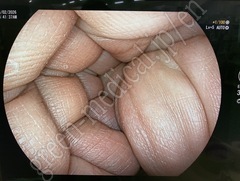 FUJIFILM Video Gastroscope