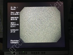 OLYMPUS Video Gastroscope